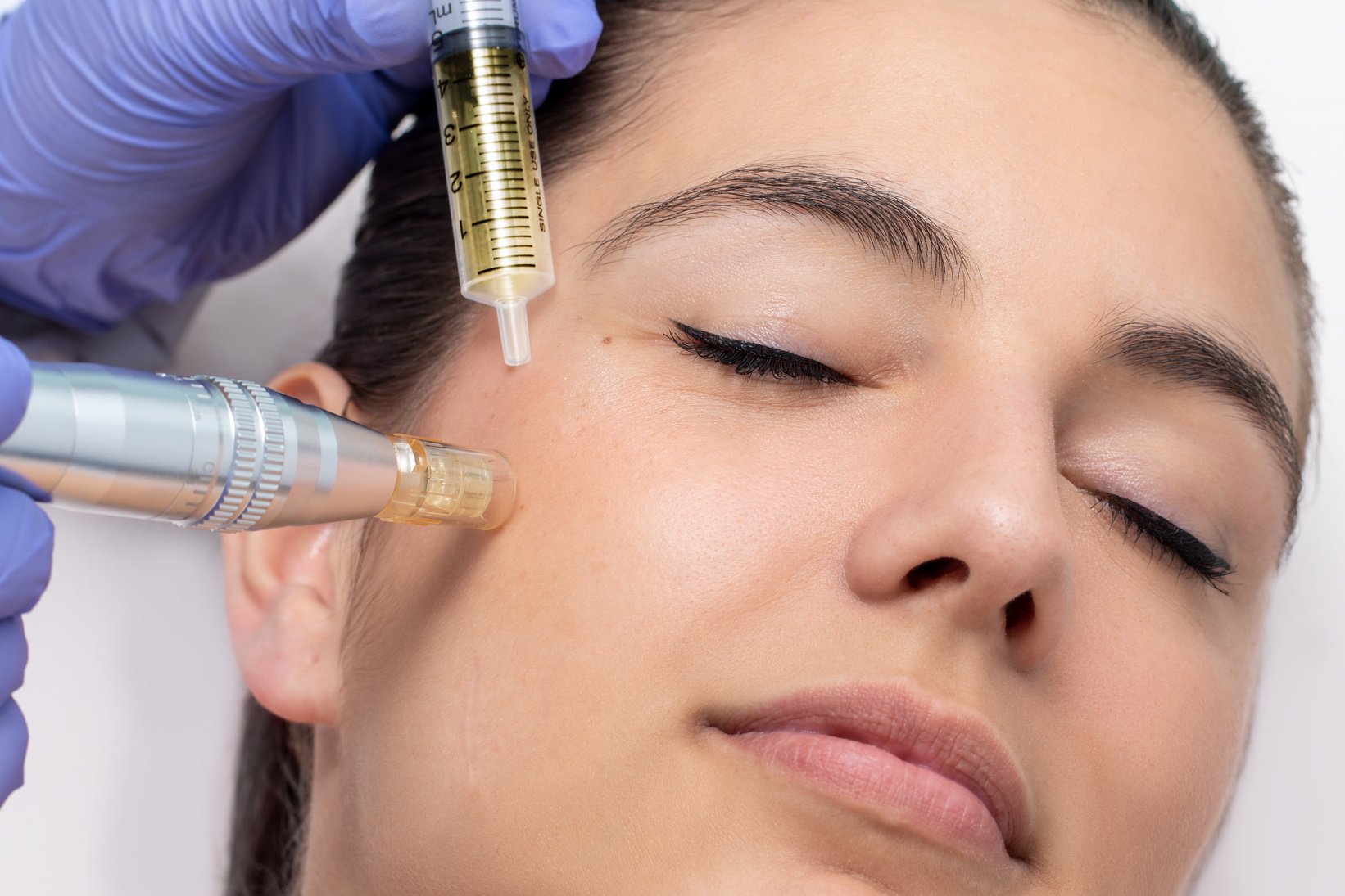 Woman having derma pen facial treatment.